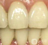 滿莊鎮(zhèn)衛(wèi)生院整牙好嗎？牙齒矯正價(jià)格在線一覽