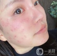 大連醫(yī)院美容科價(jià)格表及*術(shù)后果一覽