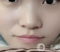 湘南醫(yī)院美容科價(jià)格表，*術(shù)后果怎么樣