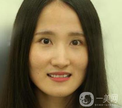 北京市海淀醫(yī)院整牙多少錢？看價格表及案例*果