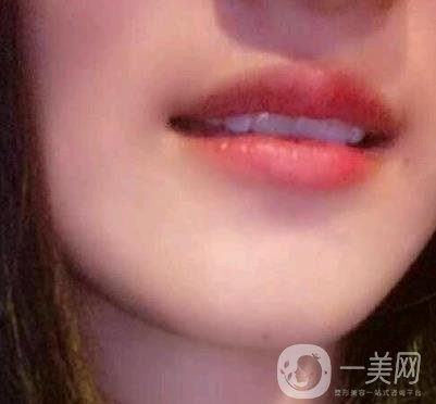 北京市海淀醫(yī)院整牙多少錢？看價格表及案例*果