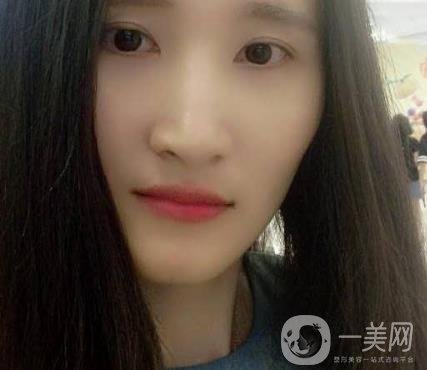 北京市海淀醫(yī)院整牙多少錢？看價格表及案例*果