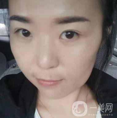 吉大一院整形美容科價(jià)格表費(fèi)用明細(xì)，附祛斑案例