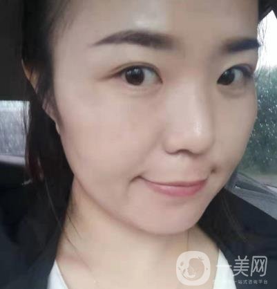 吉大一院整形美容科價(jià)格表費(fèi)用明細(xì)，附祛斑案例