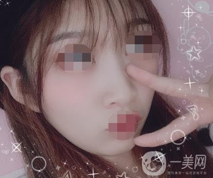 河北省中醫(yī)院整形美容科去疤*果如何？?jī)r(jià)格表及案例實(shí)拍圖公布