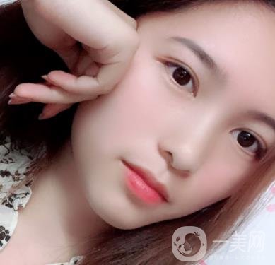 沈陽軍區(qū)總醫(yī)院整形外科價(jià)格表2020，附雙眼皮案例