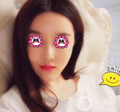 長沙中南大學(xué)*三醫(yī)院整形美容外科隆鼻多少錢？價格表及案例詳情