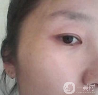 龍崗中心醫(yī)院整形外科價(jià)格表（收費(fèi)）,附去斑案例詳情