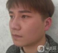 棗莊市立醫(yī)院燒傷整形美容科做光子嫩膚好嗎？?jī)r(jià)格表及術(shù)后果分享