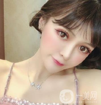 石家莊市醫(yī)院整形美容外科價格表2020，附雙眼皮實例