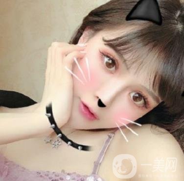 石家莊市醫(yī)院整形美容外科價格表2020，附雙眼皮實例