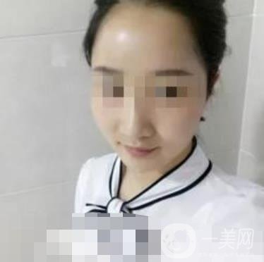 邢臺市人民醫(yī)院美容科陳譽(yù)華*案例_價(jià)格表明細(xì)