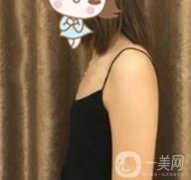 上海李斌醫(yī)療美容隆胸怎么樣?項(xiàng)目整形價(jià)格表收費(fèi)標(biāo)準(zhǔn)公布