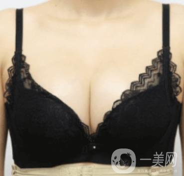 上海美貝爾明橋醫(yī)院價格(目)一覽表，附孫超醫(yī)生隆胸經(jīng)驗分享