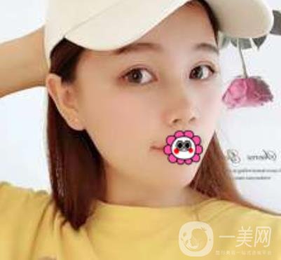 河南省人民醫(yī)院誰做雙眼皮好？附案例及2020整形價(jià)格表