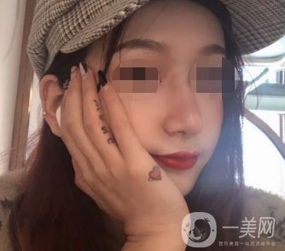 遼寧省人民醫(yī)院美容科怎么樣？附袁繼龍隆鼻案例