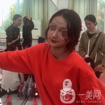 遼寧省人民醫(yī)院美容科怎么樣？附袁繼龍隆鼻案例