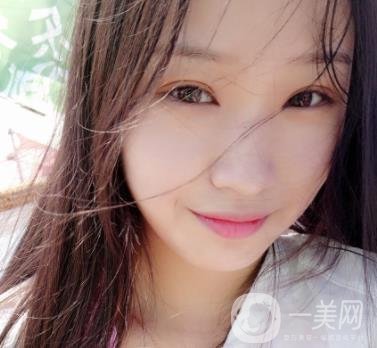 北大醫(yī)院美容價(jià)格表，附自體脂肪填充面部前后照