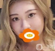 常州一院美容科價(jià)格表，*前后果圖一覽