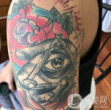 徐州市中心醫(yī)院整形科價(jià)格表，附洗紋身案例