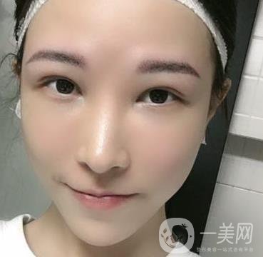 成都華美醫(yī)院做眉毛怎么樣?真實(shí)*果圖和價(jià)格一覽表展示