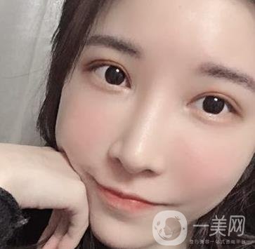 成都華美醫(yī)院做眉毛怎么樣?真實(shí)*果圖和價(jià)格一覽表展示
