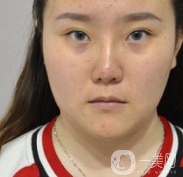 杭州市第三醫(yī)院整形價格表及*案例一覽