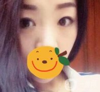 昆明市第一人民醫(yī)院雙眼皮多少錢？附案例及2020全新整形價(jià)格表