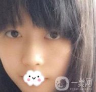 婦幼保健院劉波隆鼻怎么樣？附鼻部整形價(jià)格表一覽