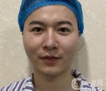 廈門(mén)邱健欽醫(yī)療美容價(jià)格表及隆鼻恢復(fù)果展示圖