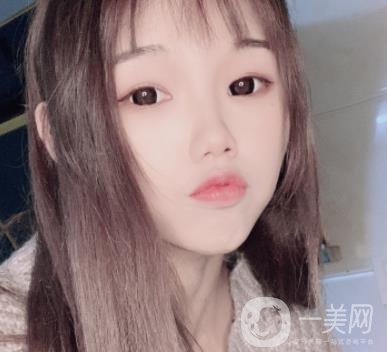 上海時(shí)光醫(yī)院何晉龍磨骨怎么樣？價(jià)格表及術(shù)后*果分享