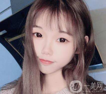 上海時(shí)光醫(yī)院何晉龍磨骨怎么樣？價(jià)格表及術(shù)后*果分享