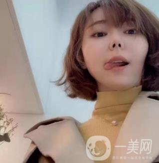 西南醫(yī)院美容整形科打*多少錢？?jī)r(jià)格表及案例*果