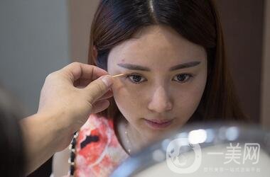 北京處整形外科價(jià)格(目)表2020一覽，附雙眼皮案例