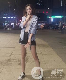 重慶西南醫(yī)院整形外科價格表2020新版出爐，附大腿吸脂案例