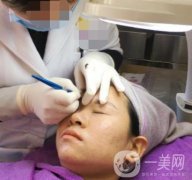 北京醫(yī)院整形科繡眉果怎么樣?2020年價(jià)格表日常收費(fèi)詳情一覽