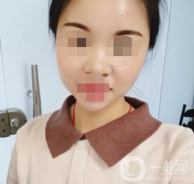 北京醫(yī)院整形科繡眉*果怎么樣?2020年價格表日常收費詳情一覽
