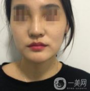 深圳人民醫(yī)院整形外科價(jià)目表，附隆鼻案例