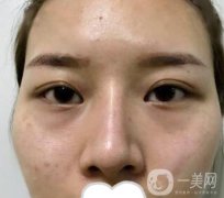 江蘇省中醫(yī)院整形科價格表及自體脂肪填充案例一覽