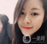 上海華美醫(yī)療美容醫(yī)院價(jià)格表，附雙眼皮修復(fù)案例