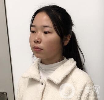 西安高一生醫(yī)療美容醫(yī)院價(jià)格表，附面部吸脂案例分享