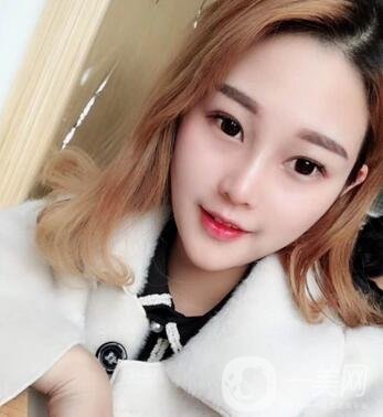 成都銅雀臺整形醫(yī)院隆鼻案例分享，附全新價格表