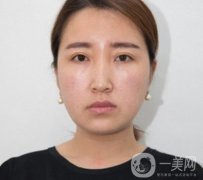 常州美貝爾整形美容醫(yī)院*注射多少錢？價格明細和果圖展示