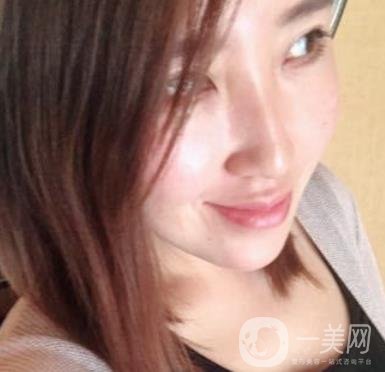 常州美貝爾整形美容醫(yī)院*注射多少錢？價格明細(xì)和*果圖展示