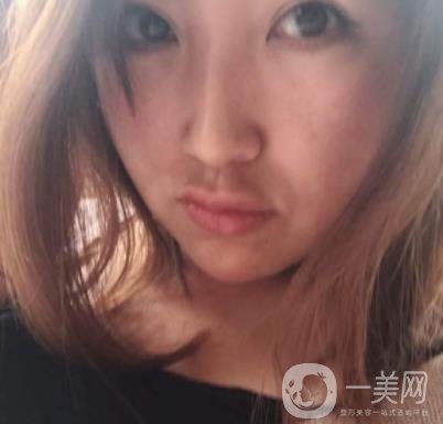常州美貝爾整形美容醫(yī)院*注射多少錢？價格明細(xì)和*果圖展示