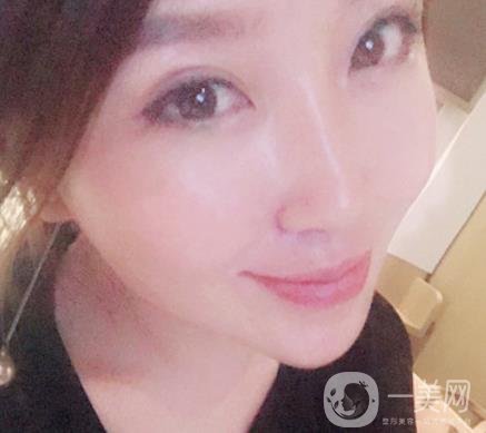 常州美貝爾整形美容醫(yī)院*注射多少錢？價格明細(xì)和*果圖展示