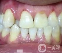 貴州口腔醫(yī)院正畸醫(yī)生信息介紹？?jī)?nèi)含牙齒美容項(xiàng)目?jī)r(jià)格表及案例