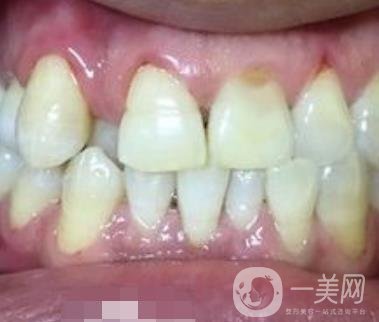 貴州口腔醫(yī)院正畸醫(yī)生信息介紹?內(nèi)含牙齒美容項(xiàng)目?jī)r(jià)格表及案例