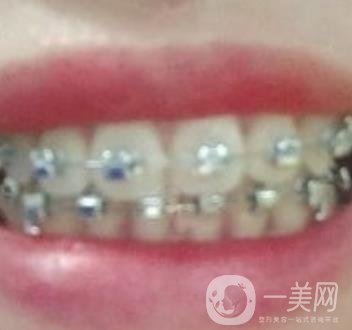 貴州口腔醫(yī)院正畸醫(yī)生信息介紹?內(nèi)含牙齒美容項(xiàng)目?jī)r(jià)格表及案例