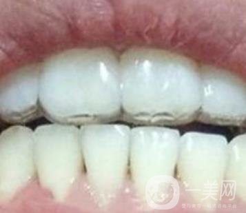 貴州口腔醫(yī)院正畸醫(yī)生信息介紹?內(nèi)含牙齒美容項(xiàng)目?jī)r(jià)格表及案例